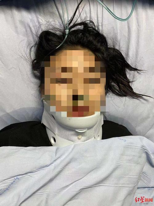 倒霉！比苏马国家队复出仅15秒再次受伤